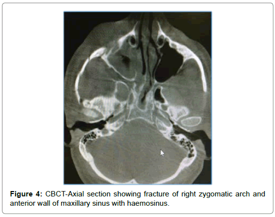 cosmetology-orofacial-surgery-CBCT-Axial