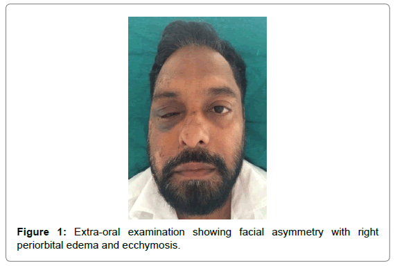 cosmetology-orofacial-surgery-Extra-oral