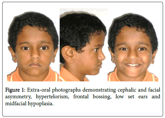 cosmetology-orofacial-surgery-Extra-oral-photographs