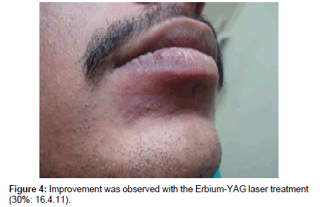 cosmetology-orofacial-surgery-Improvement-observed