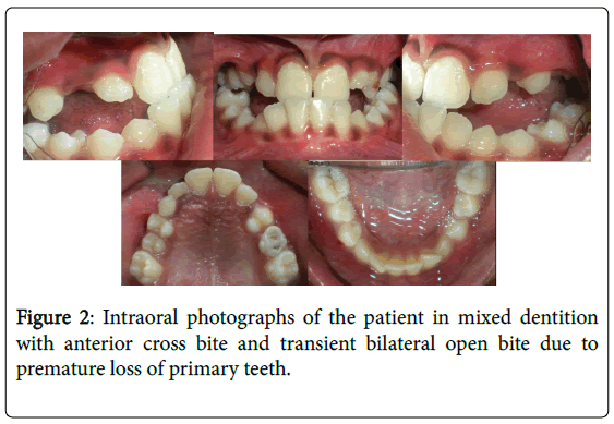 cosmetology-orofacial-surgery-Intraoral-photographs