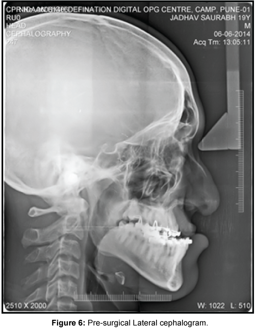 cosmetology-orofacial-surgery-Lateral-cephalogram