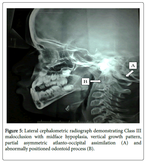 cosmetology-orofacial-surgery-Lateral-cephalometric