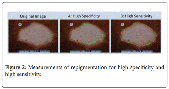 cosmetology-orofacial-surgery-Measurements-repigmentation