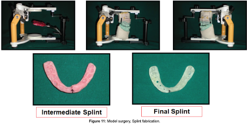 cosmetology-orofacial-surgery-Model-surgery