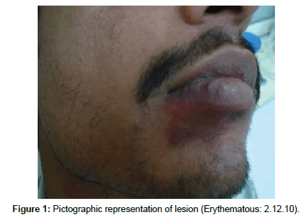 cosmetology-orofacial-surgery-Pictographic-representation