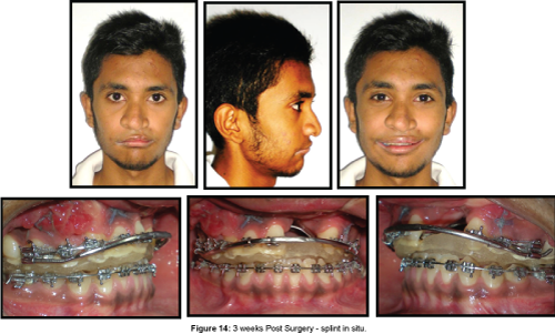 cosmetology-orofacial-surgery-Post-Surgery