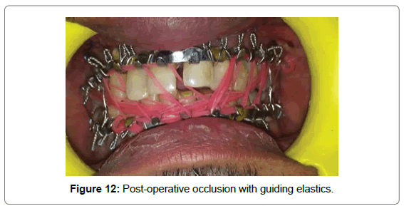 cosmetology-orofacial-surgery-Post-operative