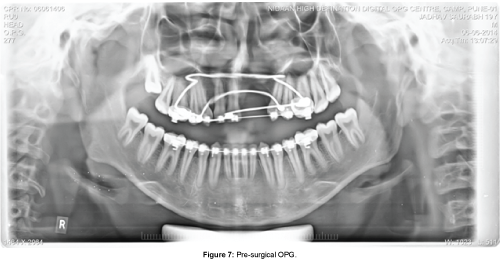cosmetology-orofacial-surgery-Pre-surgical-OPG