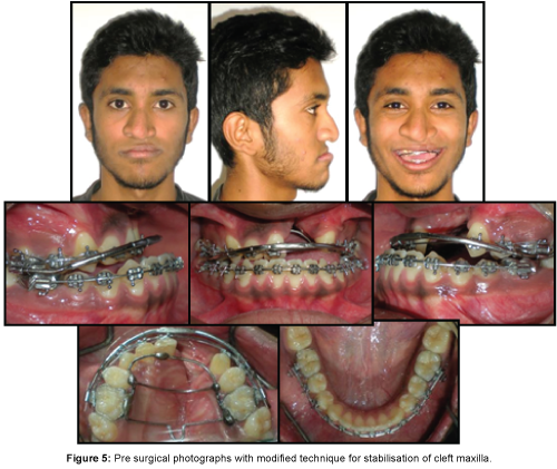 cosmetology-orofacial-surgery-Pre-surgical-photographs