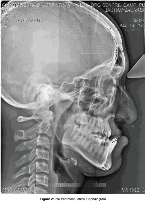 cosmetology-orofacial-surgery-Pre-treatment