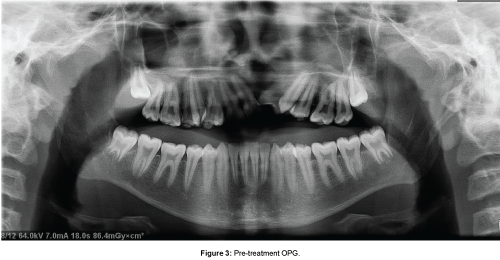 cosmetology-orofacial-surgery-Pre-treatment-OPG