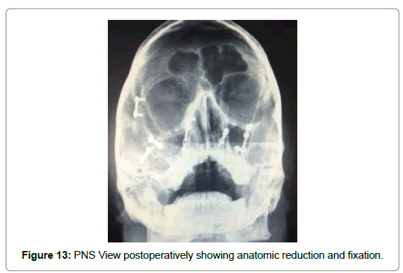 cosmetology-orofacial-surgery-View-postoperatively