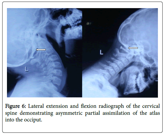 cosmetology-orofacial-surgery-flexion-radiograph