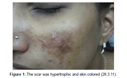cosmetology-orofacial-surgery-hypertrophic