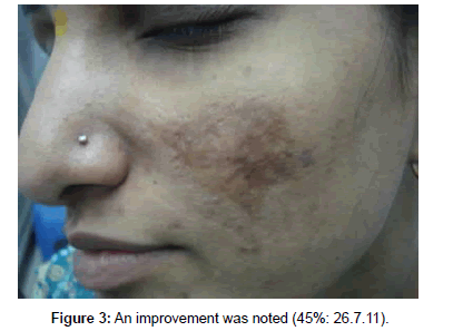 cosmetology-orofacial-surgery-improvement