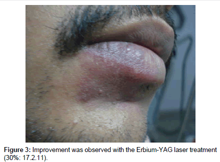 cosmetology-orofacial-surgery-laser-treatment