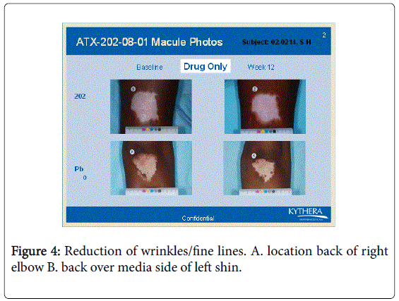 cosmetology-orofacial-surgery-media-side-left-shin