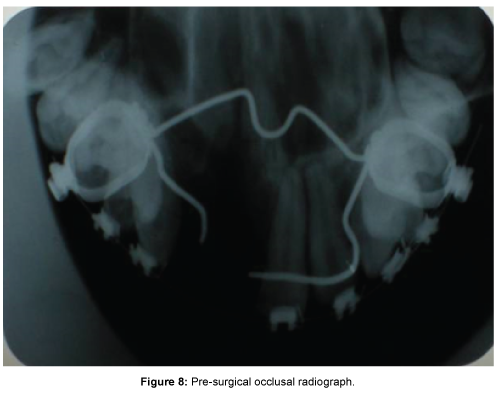cosmetology-orofacial-surgery-occlusal-radiograph