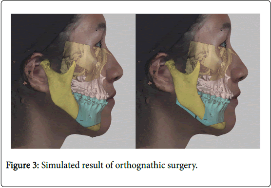 cosmetology-orofacial-surgery-orthognathic-surgery