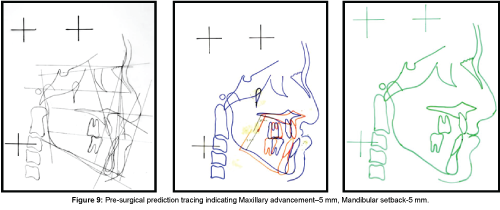 cosmetology-orofacial-surgery-prediction-tracing