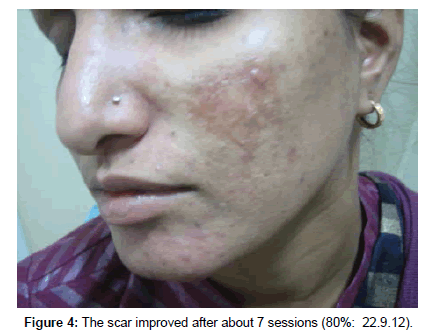 cosmetology-orofacial-surgery-scar-improved