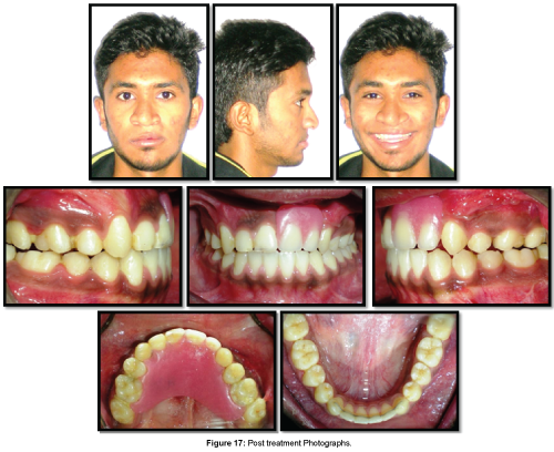 cosmetology-orofacial-surgery-treatment-Photographs