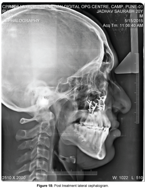 cosmetology-orofacial-surgery-treatment-lateral