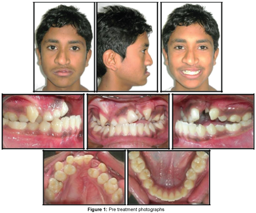 cosmetology-orofacial-surgery-treatment-photographs