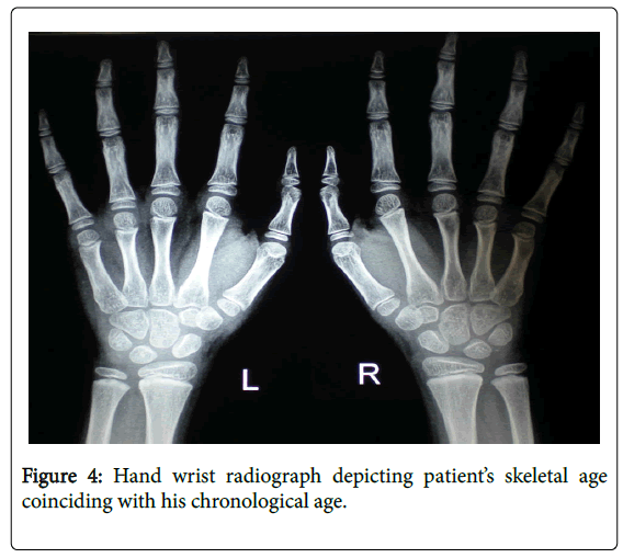 cosmetology-orofacial-surgery-wrist-radiograph