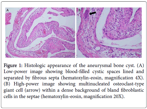 currentissue-orthopedic-oncology-Histologic-appearance