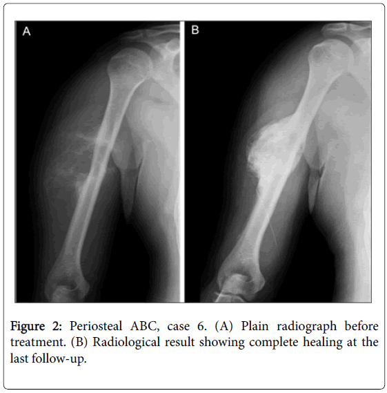 currentissue-orthopedic-oncology-Plain-radiograph