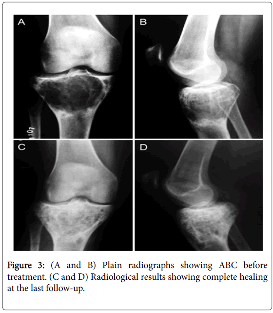 currentissue-orthopedic-oncology-complete-healing