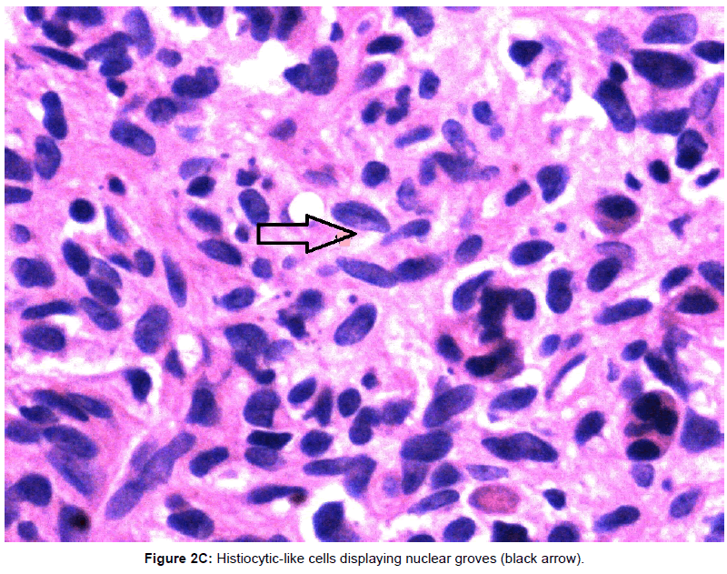 currentissue-orthopedic-oncology-nuclear-groves