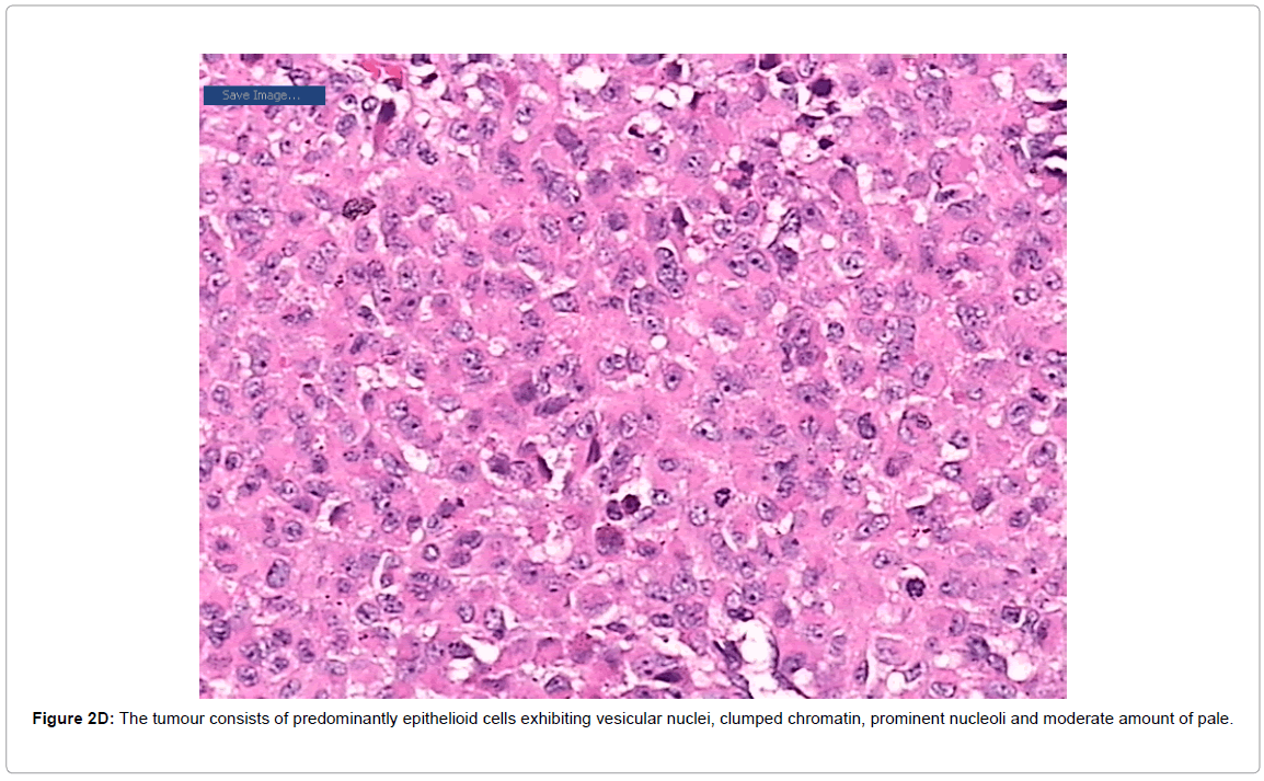 currentissue-orthopedic-oncology-tumour-consists
