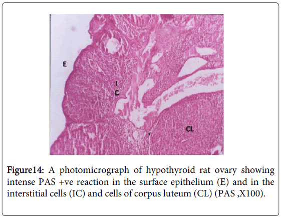 thyroid glands essay The word part needed to complete the term meaning incision of the thyroid gland, thyroid/o/_____, is: tomy the abbreviation for the medical term for the procedure that assesses thyroid function by testing the ability of the thyroid gland to trap and retain radioactive iodine following oral ingestion of the iodine is. thyroid glands essay The word part needed to complete the term meaning incision of the thyroid gland, thyroid/o/_____, is: tomy the abbreviation for the medical term for the procedure that assesses thyroid function by testing the ability of the thyroid gland to trap and retain radioactive iodine following oral ingestion of the iodine is.