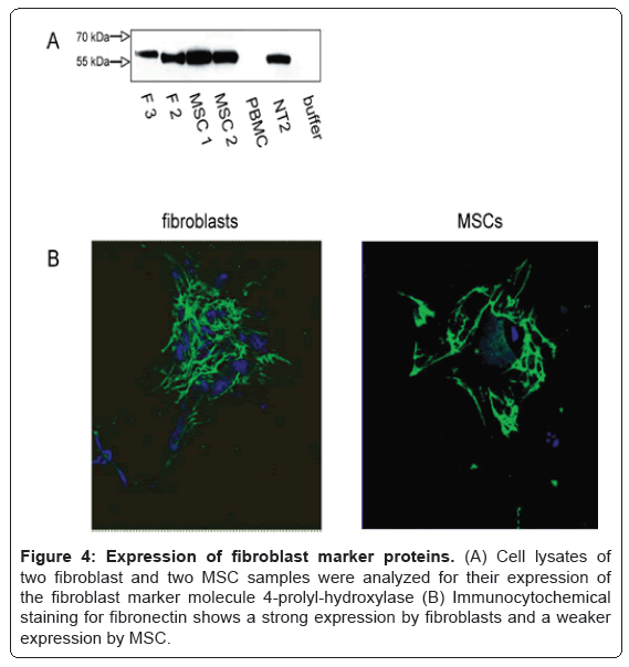 cytologyhistologyfibroblastmarkerproteins