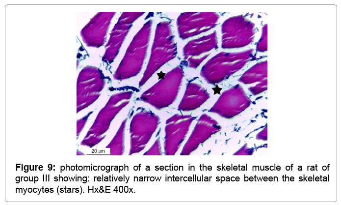 footprinting of nucleic