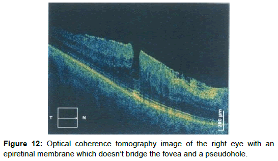 Cytology Histology Optical Coherence Tomography Cytology Histology Optical Coherence Tomography