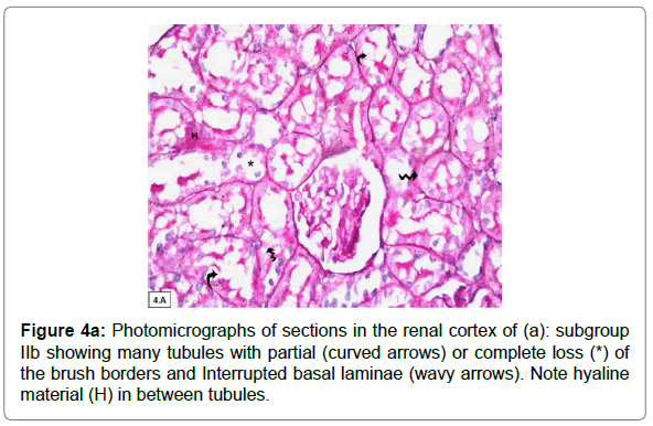 Viagra effect on kidneys