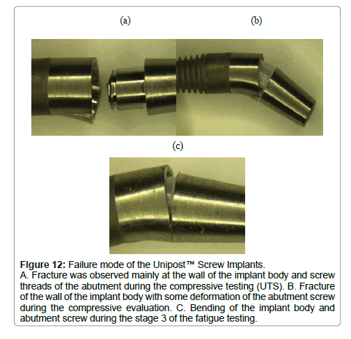 dental-implants-dentures-fracture