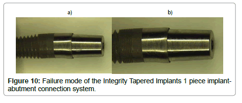dental-implants-dentures-implantabutment