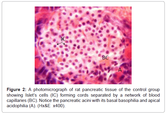 analysis of rat pancreatic islets Expression and distribution of somatostatin receptor subtypes in the pancreatic islets of mice and rats a quantitative analysis of the co-localization was performed all ssts were expressed in the pancreatic islets and co-localized on islet cells to various extents a majority of the in pancreatic islets of mice and rats. analysis of rat pancreatic islets Expression and distribution of somatostatin receptor subtypes in the pancreatic islets of mice and rats a quantitative analysis of the co-localization was performed all ssts were expressed in the pancreatic islets and co-localized on islet cells to various extents a majority of the in pancreatic islets of mice and rats.