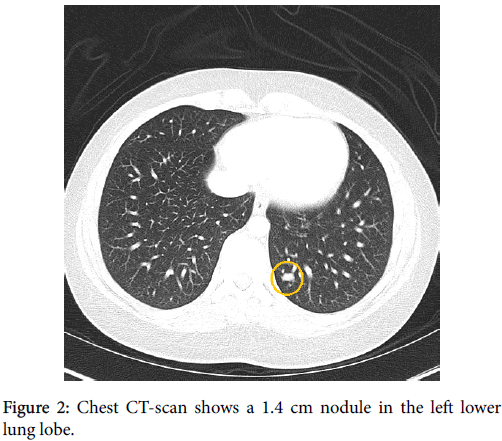 diagnostic-pathology-Chest-CT-scan