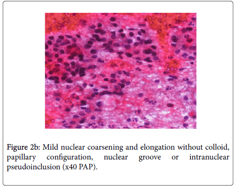 diagnostic-pathology-Mild-nuclear