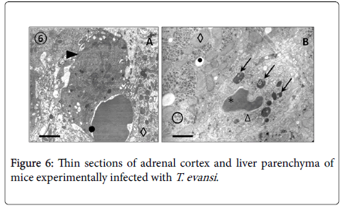 diagnostic-pathology-adrenal-cortex