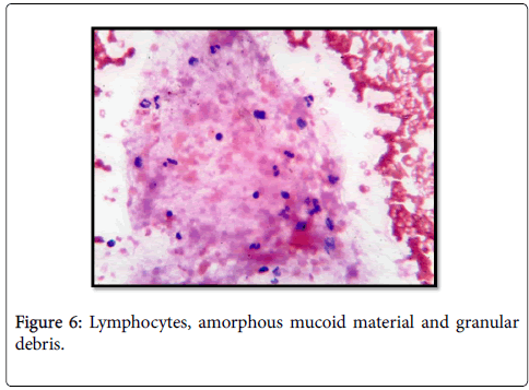 diagnostic-pathology-amorphous-mucoid