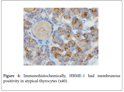 diagnostic-pathology-atypical-thyrocytes