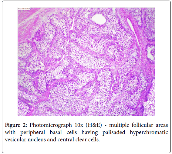 diagnostic-pathology-central-clear-cells