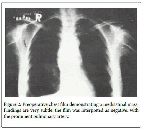 diagnostic-pathology-chest-film